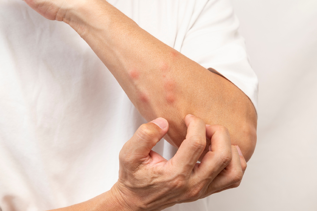 Фото: Shutterstock