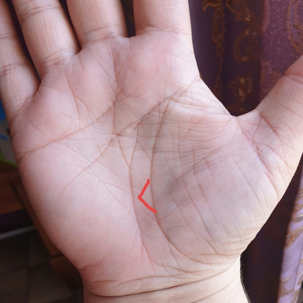 Треугольник на линии жизни. https://dzen.ru/a/YTp6Ukwoc0AVqaiC