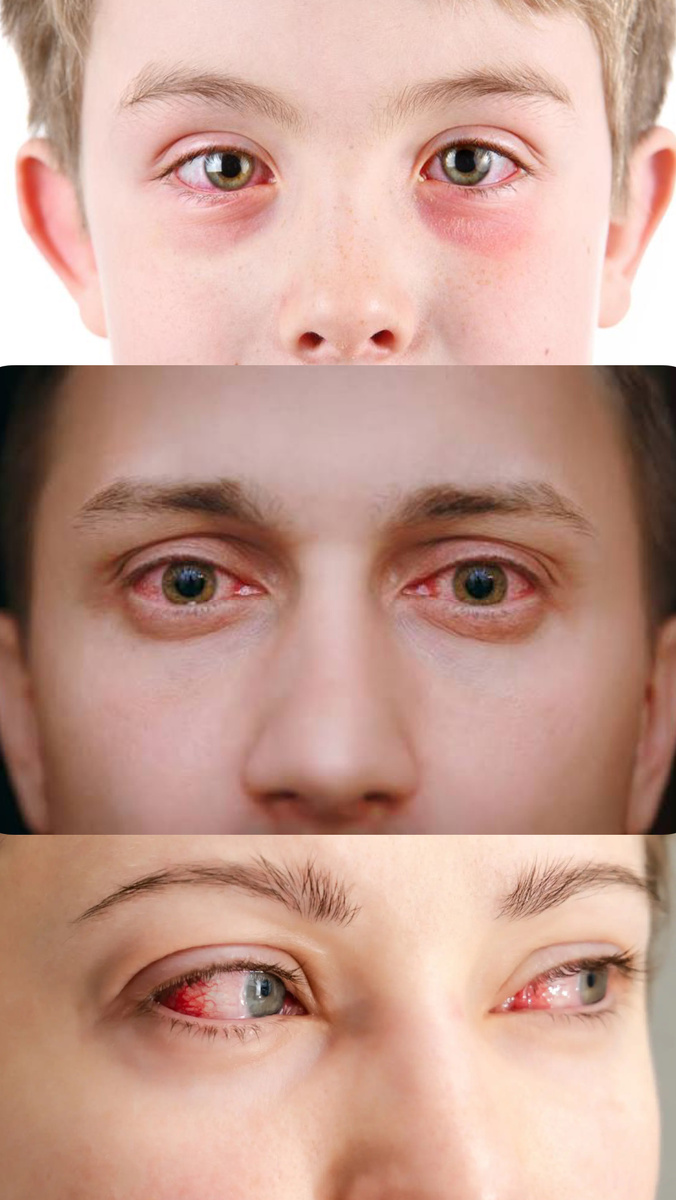 Рекомендация общая и для детей и для взрослых 