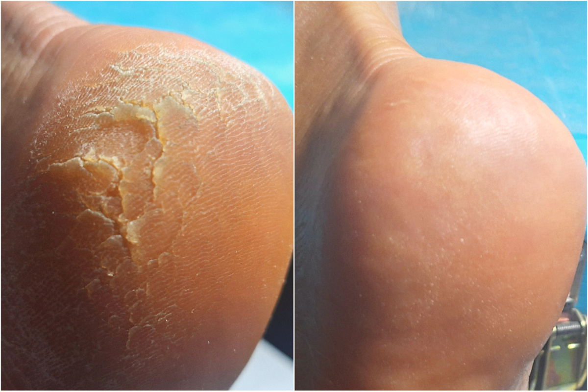 Обработка пяточек в своей любимой технике. 