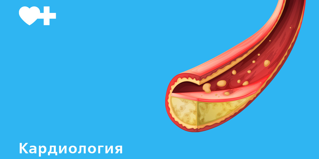 Хороший и плохой холестерин: какие показатели считаются нормой