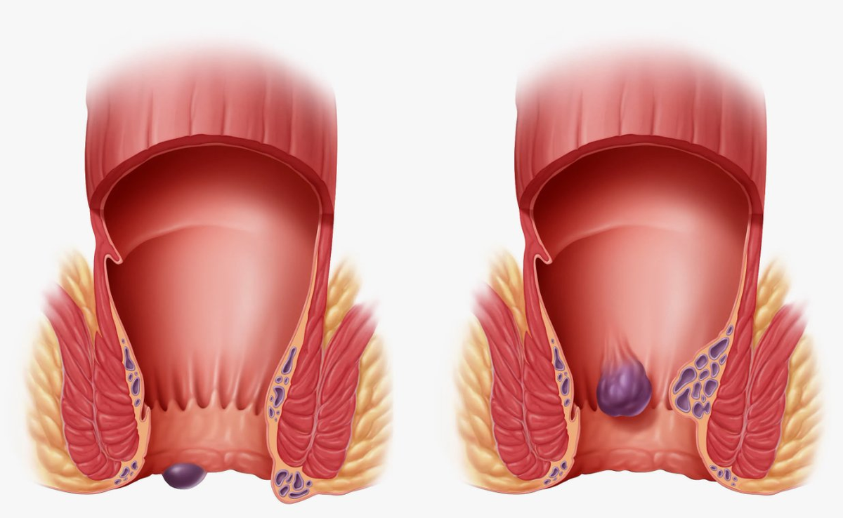 Фото: Яндекс Картинки 