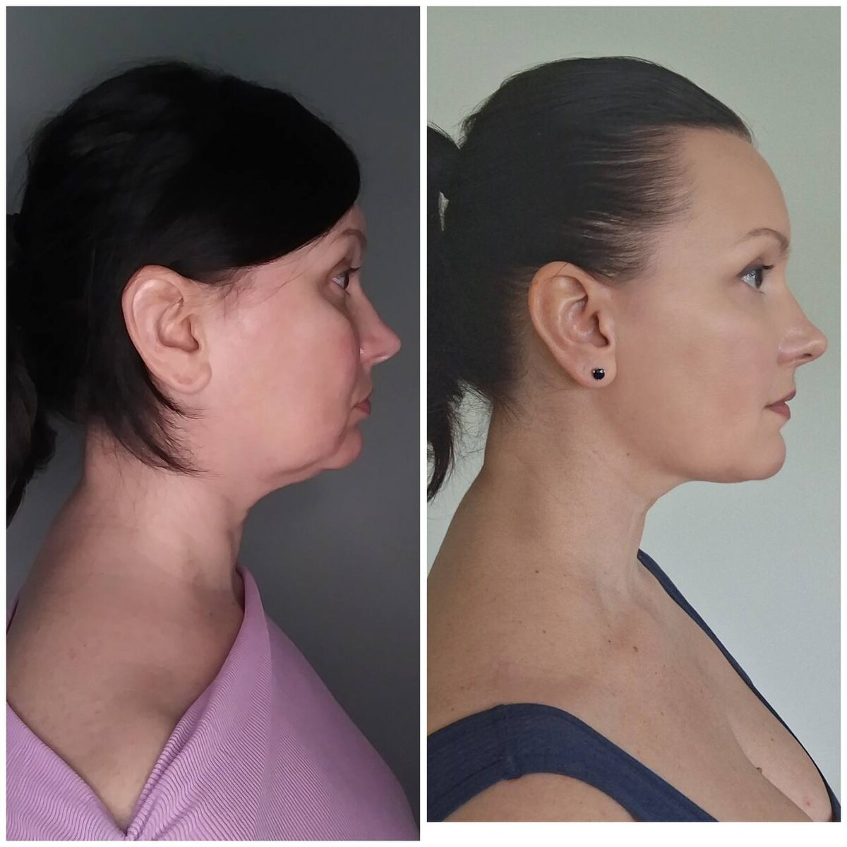 До и после программы "DIVAПреображение"