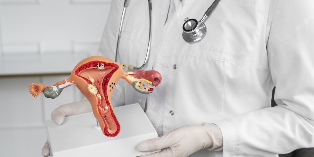 Удалять матку при миоме: правда о последствиях и когда есть выбор