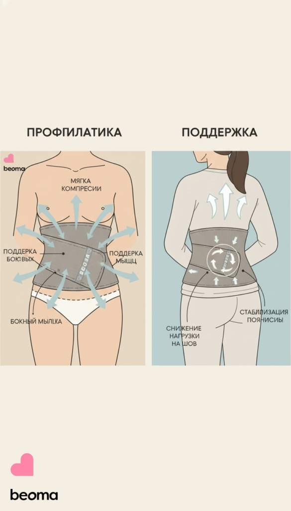    profilaktika_spaechnoogo_protsessa_posle_kesareva_5_sposobov_dlya_vosstanovleniya_zdorovya_mamy Beoma