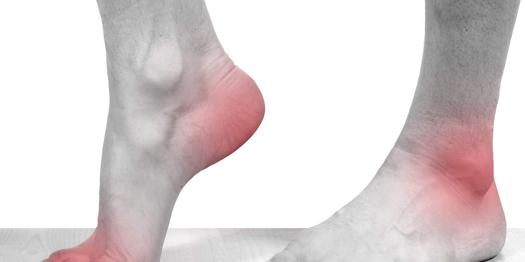 Подагра: ночная атака на суставы. Как выжить и предотвратить