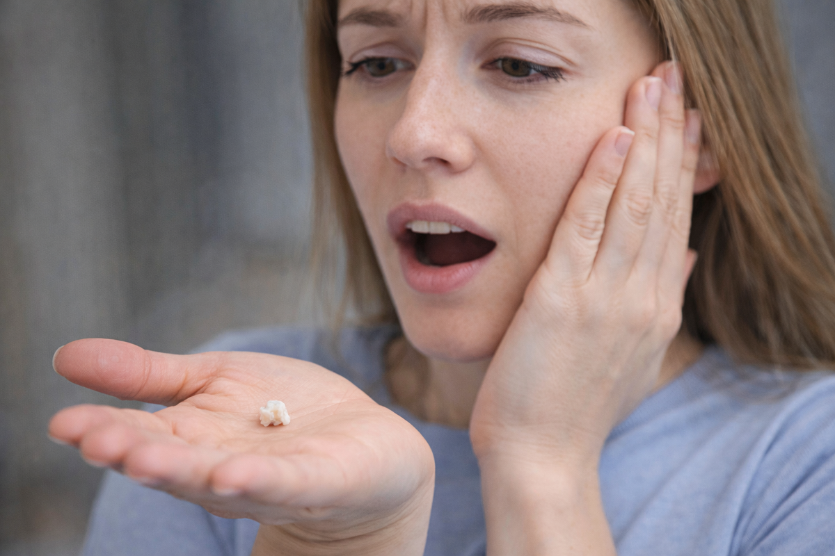 Выпала пломба у девушки