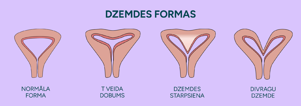 Толщина этих стенок варьируется от 1 см до 3 см