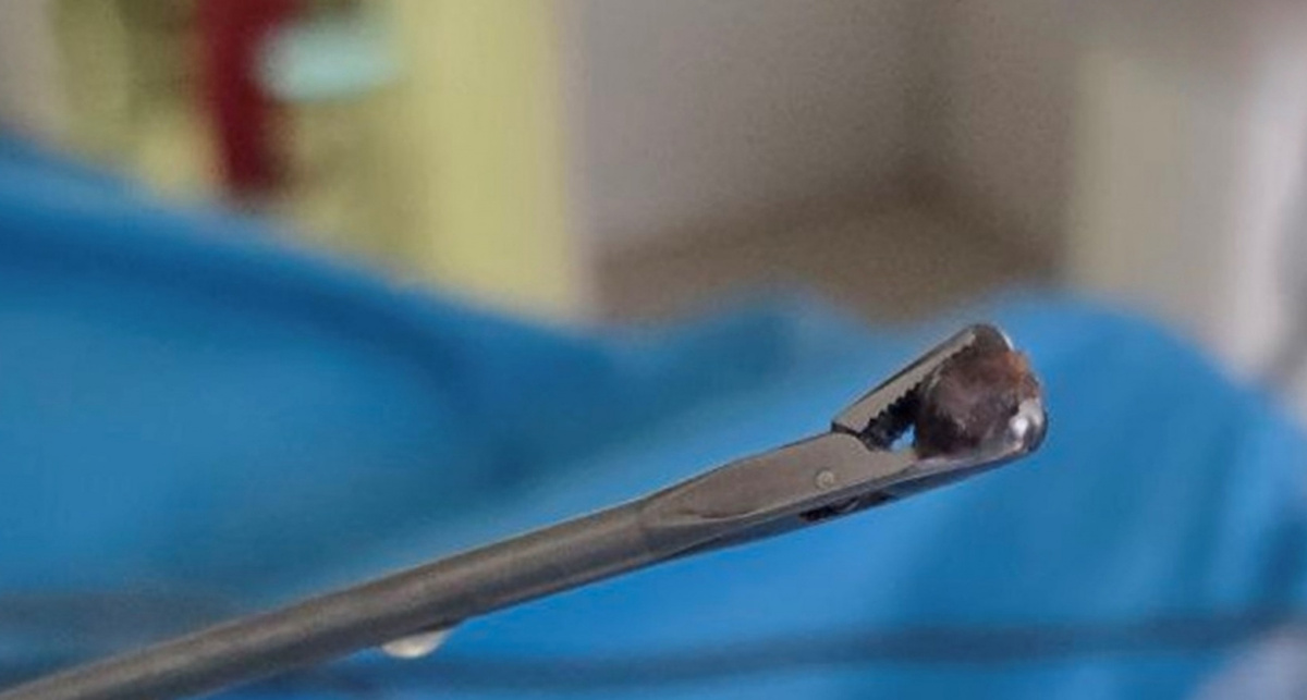    Фото Новочебоксарской городской больницы