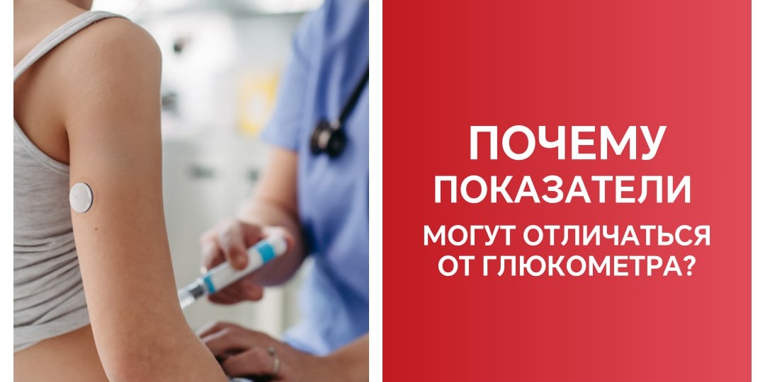 📈 Принцип измерения уровня глюкозы в системе непрерывного мониторинга