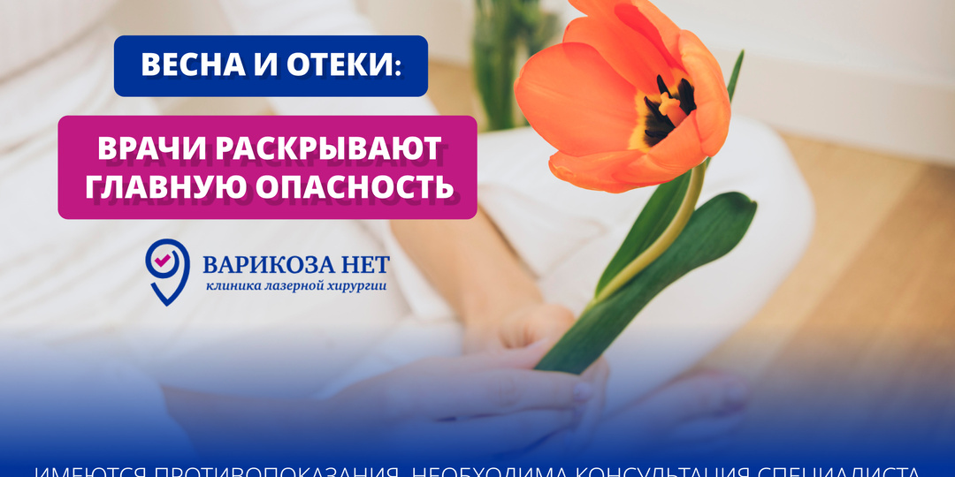 Весна и отеки: врачи раскрывают главную опасность