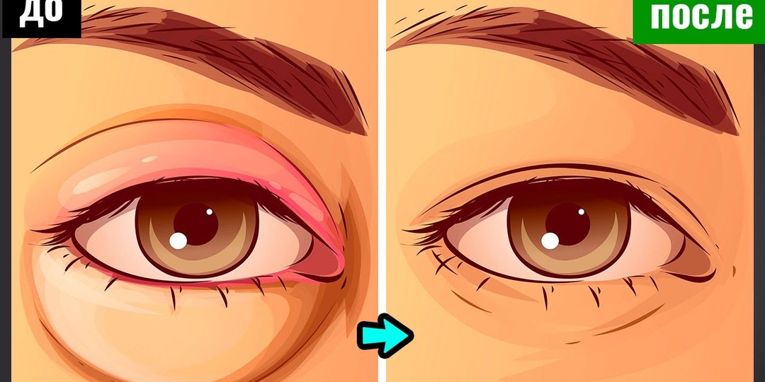 Этот признак может появиться внезапно