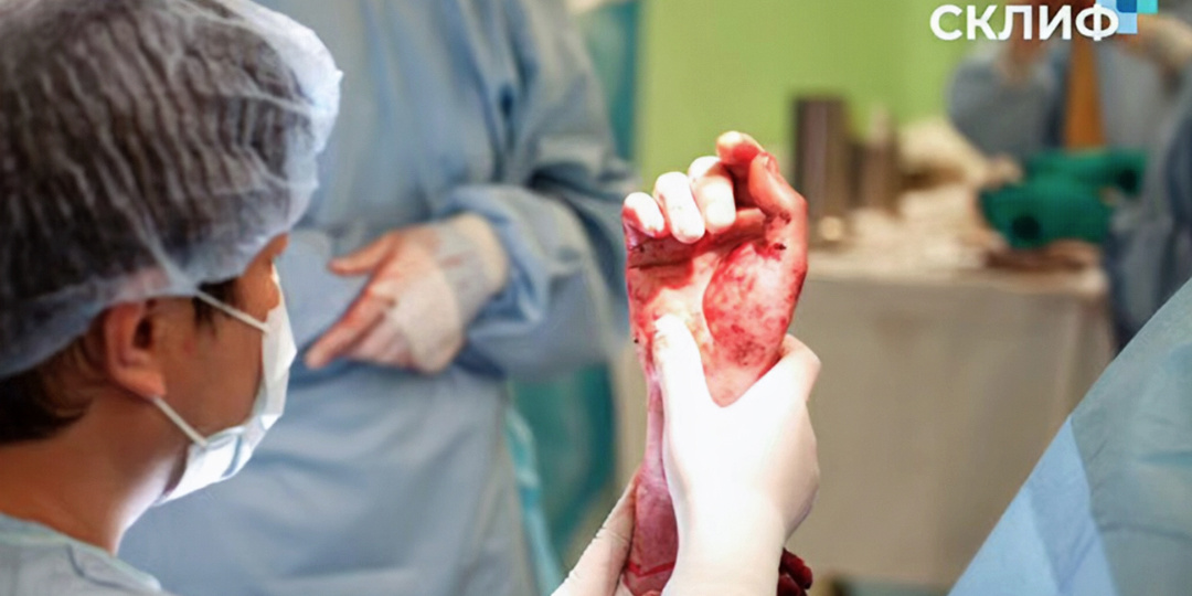 В Москве врачи успешно пересадили руки 42-летнему мужчине