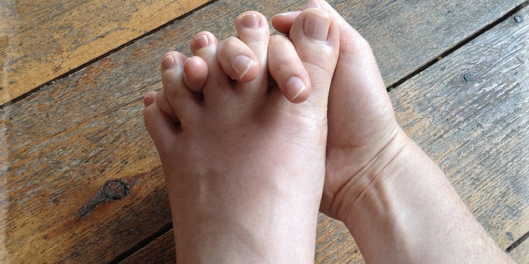 Техника омоложения «Переплетение пальцев рук и ног»: рабочий вариант