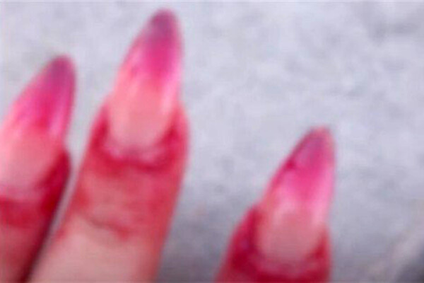 Yonhap News TV   📷