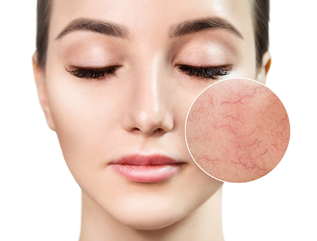 Любая процедура требует честного понимания её возможностей и ограничений, чтобы ожидания пациента соответствовали реальному результату.