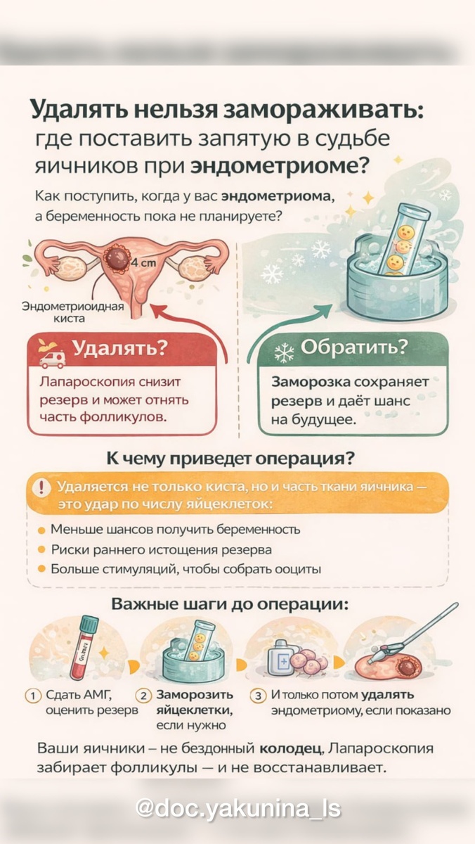 🎯 Удалять нельзя замораживать: где поставить запятую в судьбе яичников при эндометриоме?