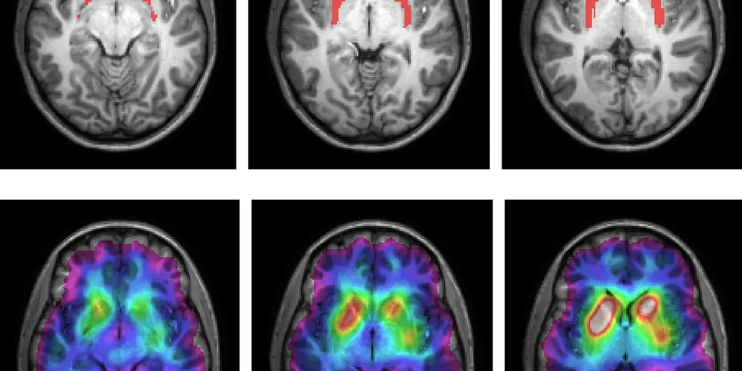 Как нейробиолог, я отказался от этих 5 утренних привычек, которые разрушают ваш мозг