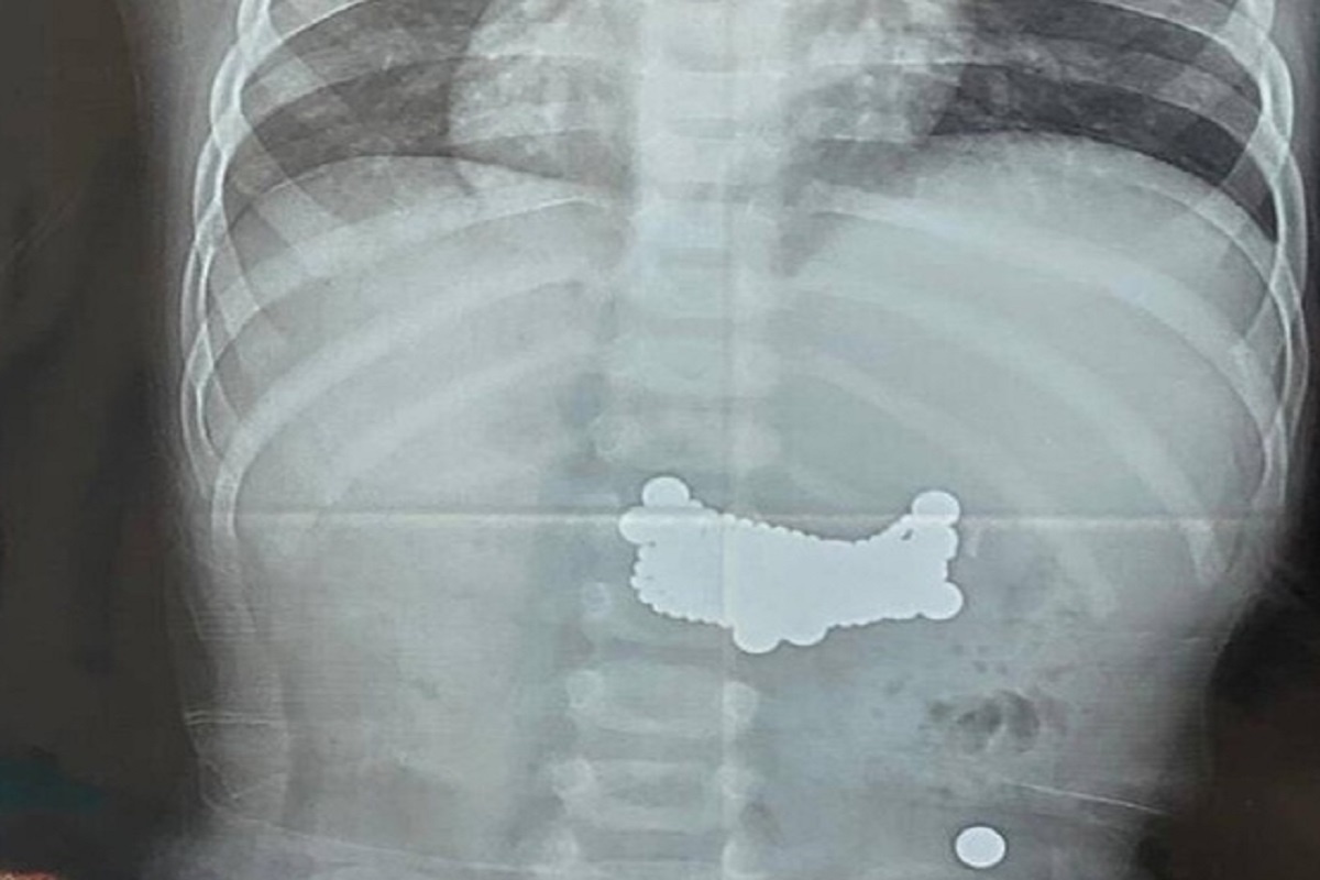    Фото: Telegram-канал «Дагестан»