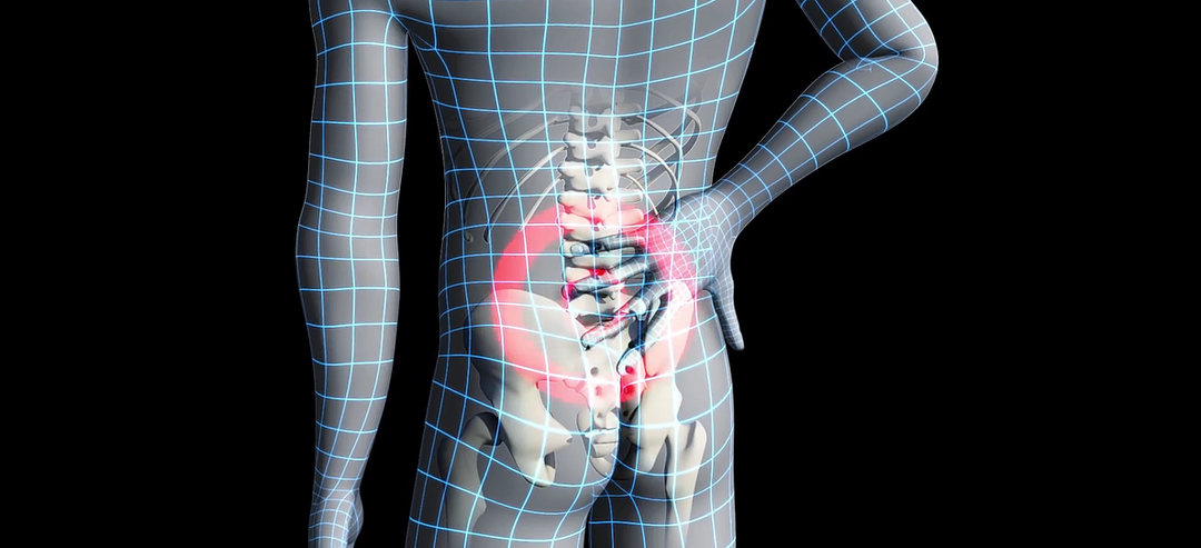 Варикоз, запоры, миомы - три разных врача. Одна причина!