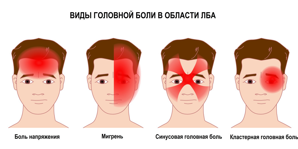 Как головные боли связаны с прикусом, поясницей, стопами и биомеханикой