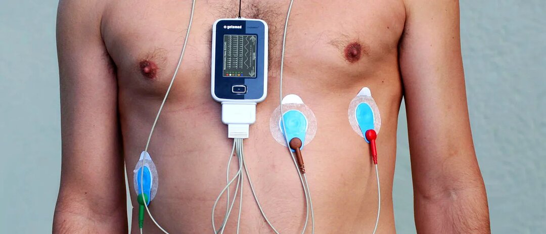 Что такое холтер и почему обычная кардиограмма часто врет