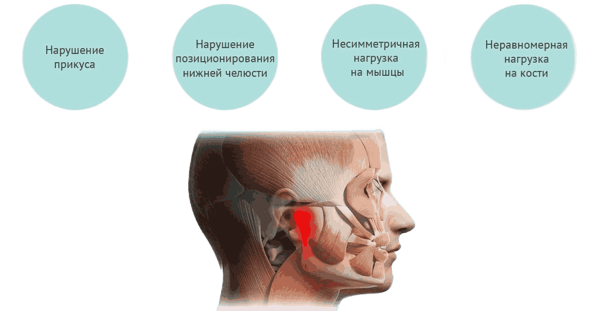 Причины нарушений работы височно-нижнечелюстного сустава