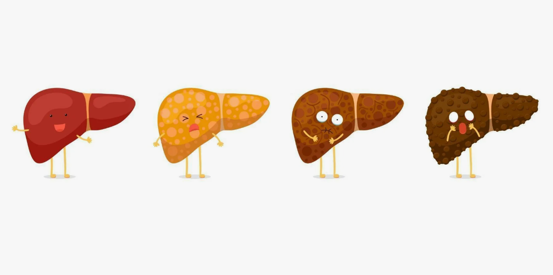 Алкогольная болезнь печени: симптомы и стадии. Как понять, что печень умирает?