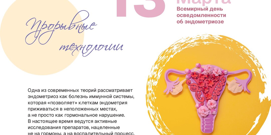 13 марта — Всемирный день осведомлённости об эндометриозе: болезнь, которую медицина учится распознавать быстрее