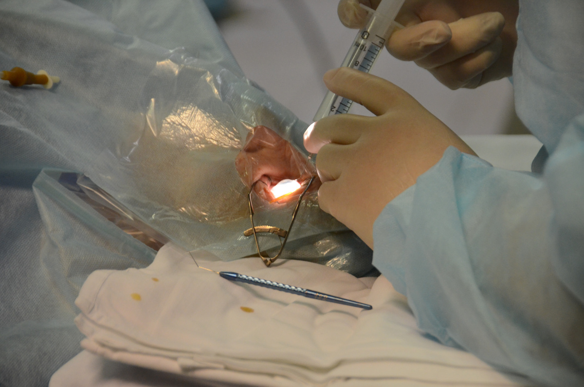 В Петербург на треть выросло число трансплантаций.  Фото: Татьяна Буторина