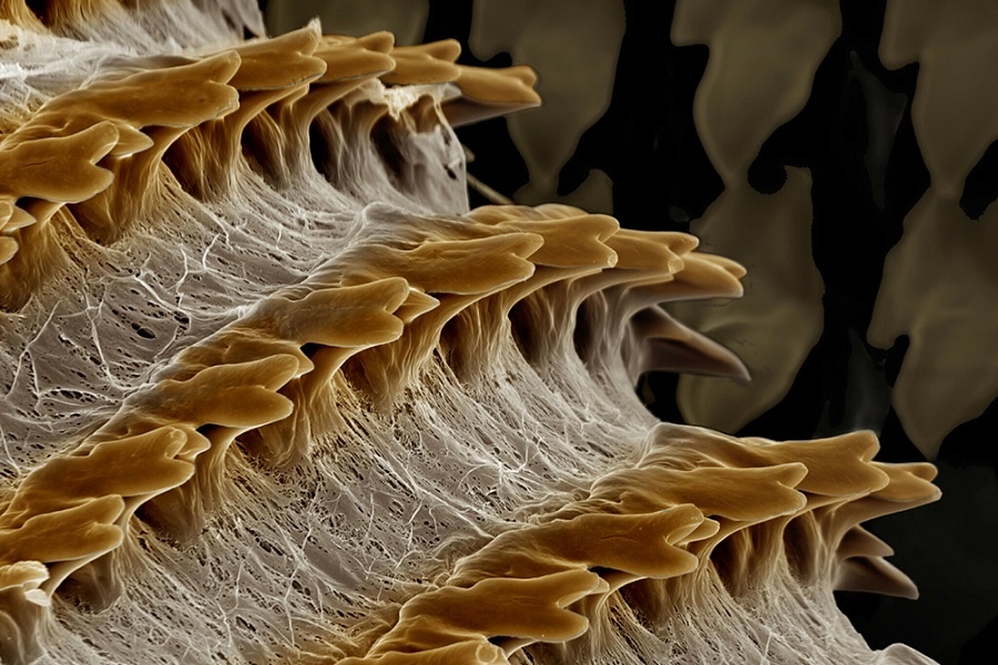 Радула под микроскопом. Фотография из интернета