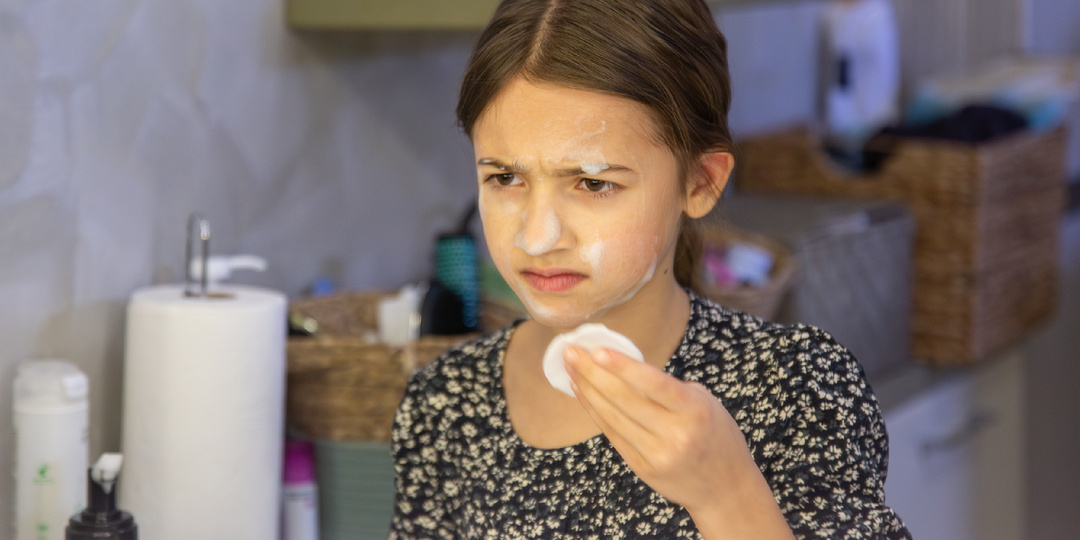 Подростковые прыщи: лечить или не трогать