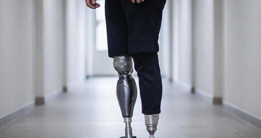 Хирург предлагает резать снова, а у тебя нет денег даже на билет до госпиталя. Разбираемся, как отказаться от операции и не остаться без ВВК