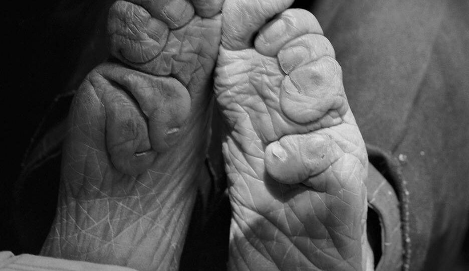 Бинтование ног в Китае, часть 1