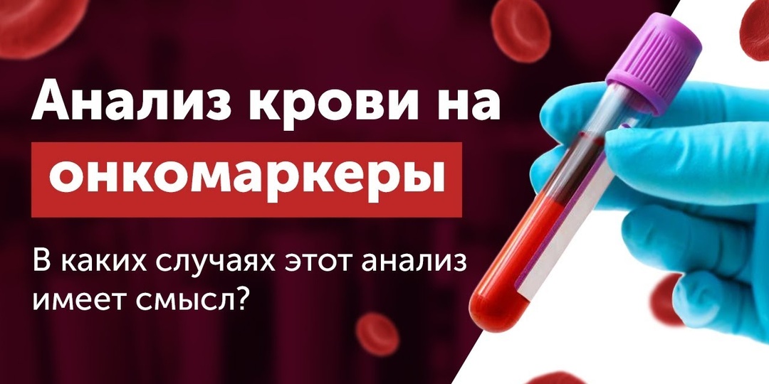 Гид по Онкомаркерам: какие из них действительно информативны для профилактики, а какие являются пустой тратой денег?