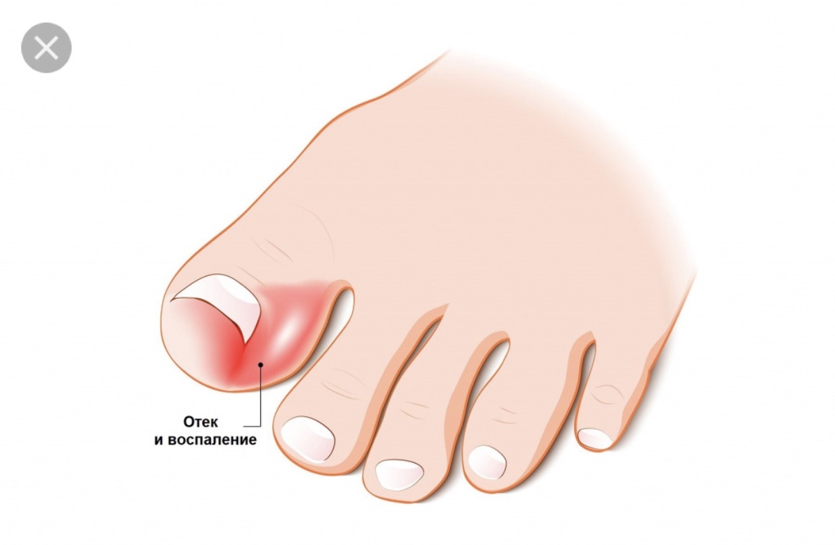 Эстетики ради вместо фото «натюрэль» приложу рисунок. Очень похоже, только не красное 