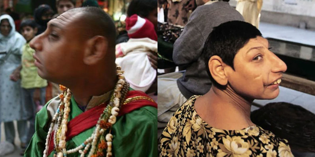 Кто такие «крысы Шаха Дола» и другие интересные факты