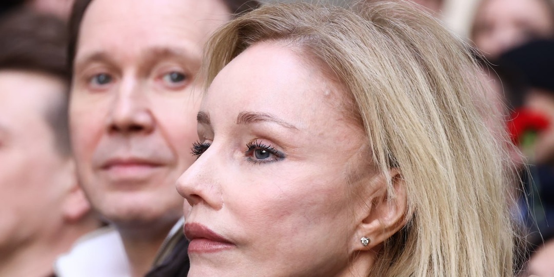 Как на самом деле выглядят без фильтров российские звёзды. 10 фото от Литвиновой до Зудиной