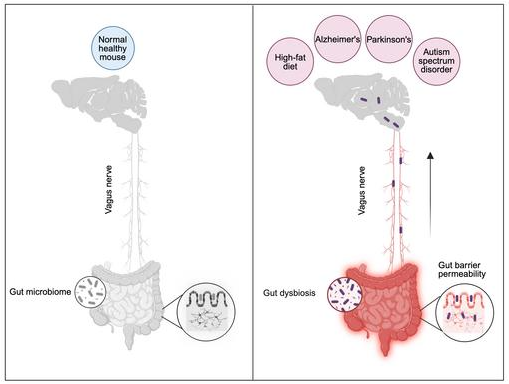 Новый путь перемещения кишечных бактерий в головной мозг через блуждающий нерв, обнаруженный в исследовании на мышах при диете с высоким содержанием жиров или при различных неврологических заболеваниях, таких как болезнь Альцгеймера, Паркинсона и аутизм. (источник:  https://journals.plos.org/plosbiology/article?id=10.1371/journal.pbio.3003652 )