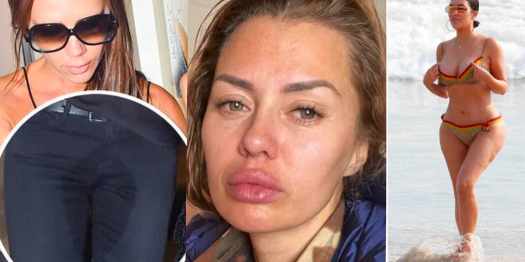 Неудобные фото звёзд, которые они бы хотели забыть как страшный сон.