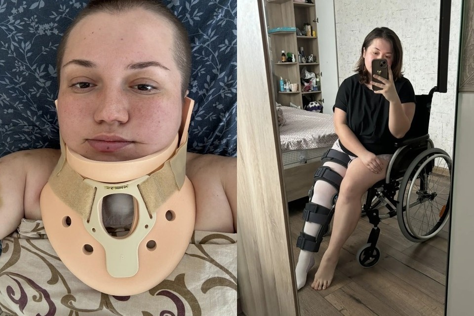 День защиты диплома закончился для сибирячки реанимацией и комой. Фото: предоставила Анастасия.