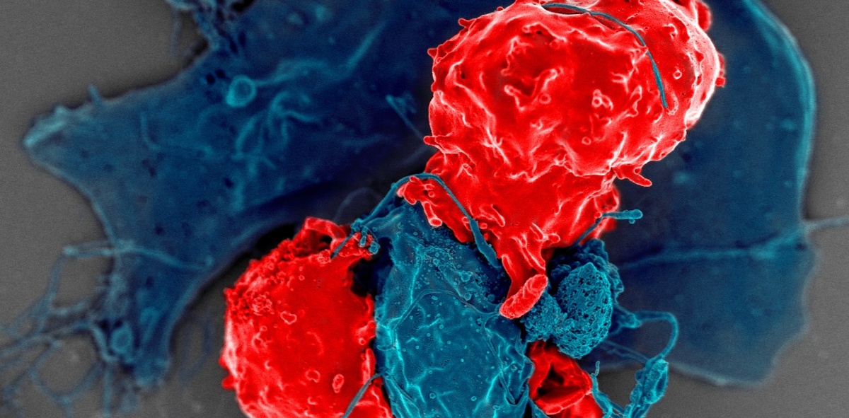 Регуляторные Т-клетки (красным цветом), взаимодействуют с антигенпрезентирующими клетками (синим). Регуляторные Т-клетки способны подавлять реакции Т-лимфоцитов для предупреждения чрезмерной активации в иммунной системе. Сканирующая электронная микроскопия, © PDM 1.0/ NIH Image Gallery