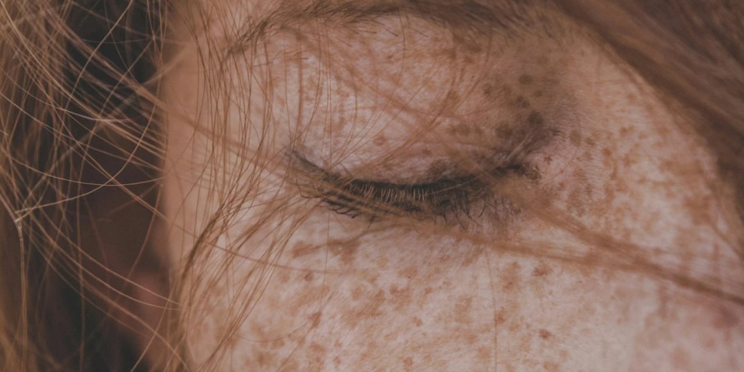 🟡 Как кожа может сигнализировать о проблемах с желчным пузырём