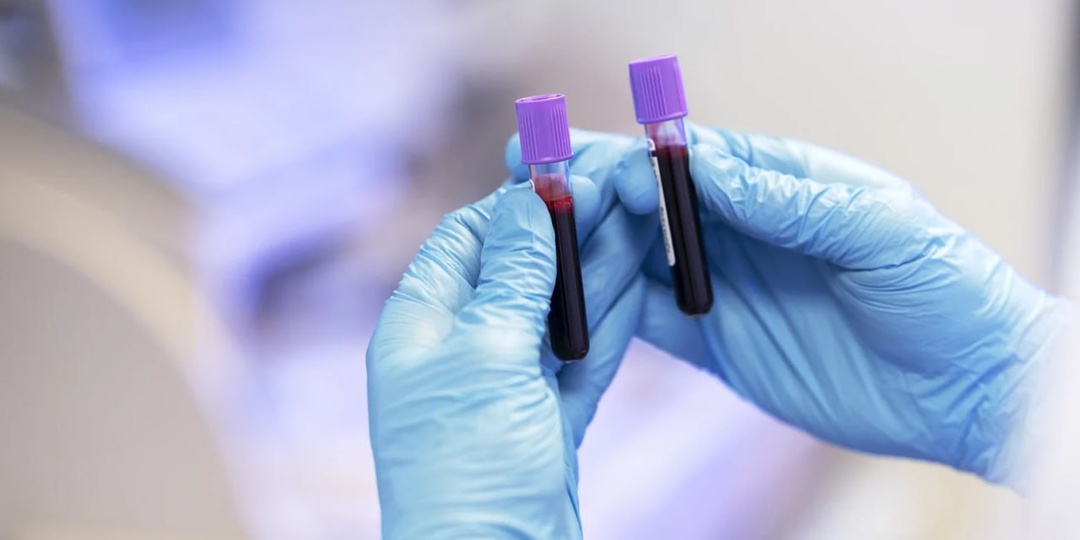 🧪 Анализы крови на гормоны: зачем их назначают