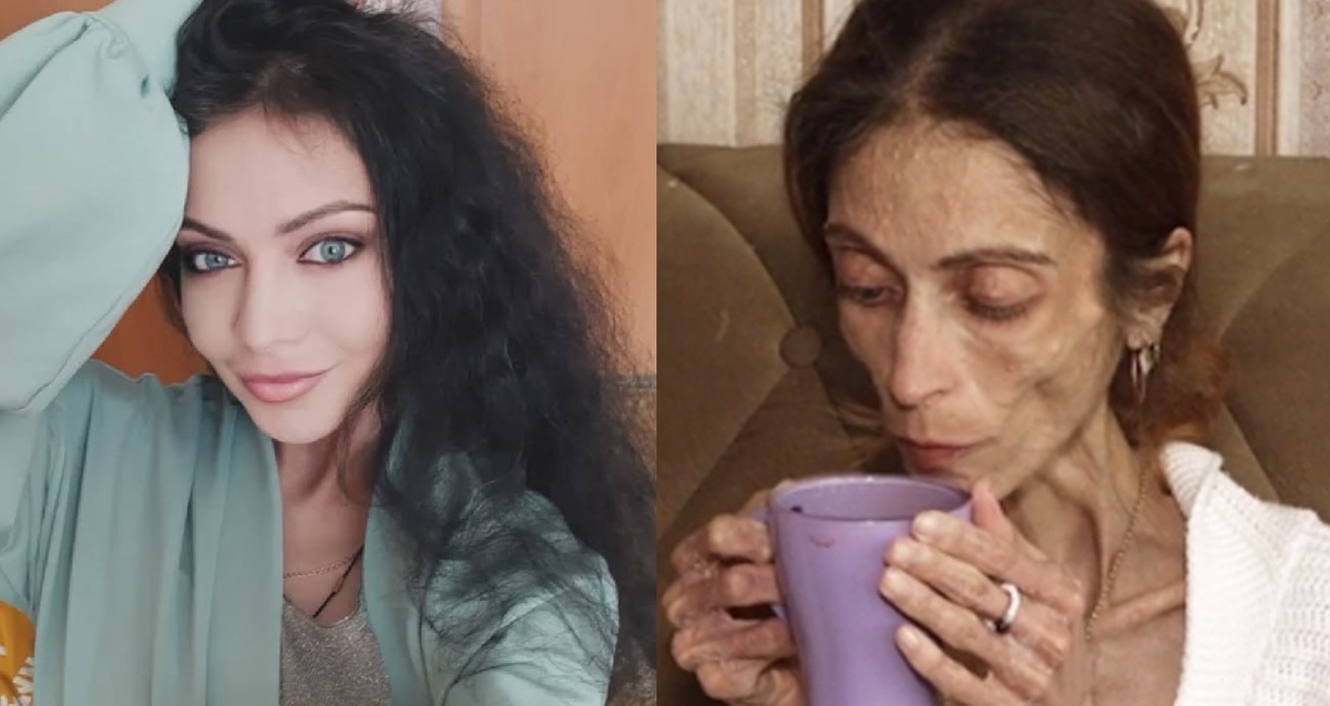 Яна Боброва победила анорексию. Фото: соцсети