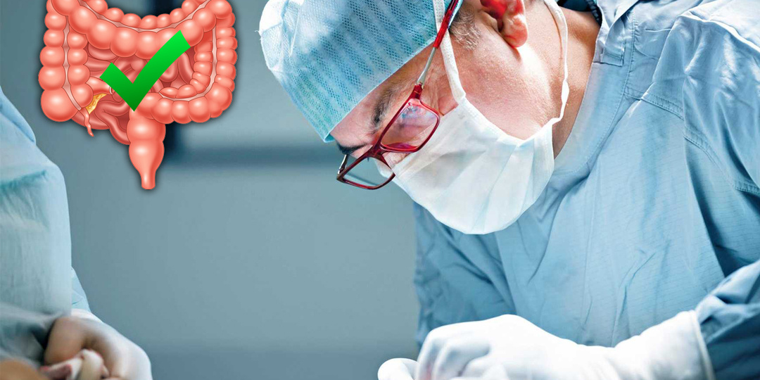 ХИРУРГИЧЕСКОЕ ЛЕЧЕНИЕ КИШЕЧНОЙ НЕПРОХОДИМОСТИ: Всё, Что Вам Нужно Знать