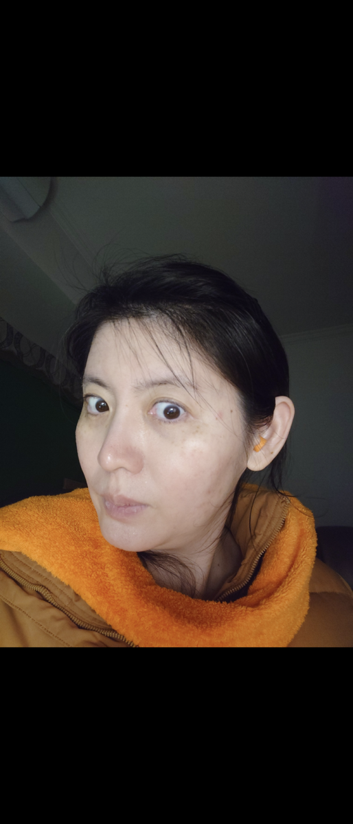 "155" или "149" 20/30 — это очередная теория заговора от кучки бесполезных приложений.

30/30 я разработал собственный метод лечения системной красной волчанки. От оказания первой помощи до полного выздоровления мне потребовалось всего пять недель без помощи врача.


Самое главное, я никогда не встаю рано утром, а просыпаюсь только к полудню, и я разработал собственный метод лечения системной красной волчанки. От оказания первой помощи до полного выздоровления мне потребовалось всего пять недель без помощи врача. Я только что выздоровел от очень тяжелой формы системной красной волчанки, которая была вызвана незаметно загрязненной минеральной водой, сильно поврежденной во время транспортировки в результате так называемого заговора. Я пил эту минеральную воду, не замечая, что она загрязнена, пока третья бутылка не наполнилась вонючим газом.
(Я сохранила эту бутылку для аукциона в будущем) Для тех преступников, которые не хотят видеть, что я добиваюсь огромных компенсаций за нарушение авторских прав на «Labubu» и «Pop-mart», любой, кто хочет узнать секрет, может связаться со мной по адресу bestmusicsasha1@mail.ru
У меня нет записей о госпитализации, это правда. Я все вылечила сама.