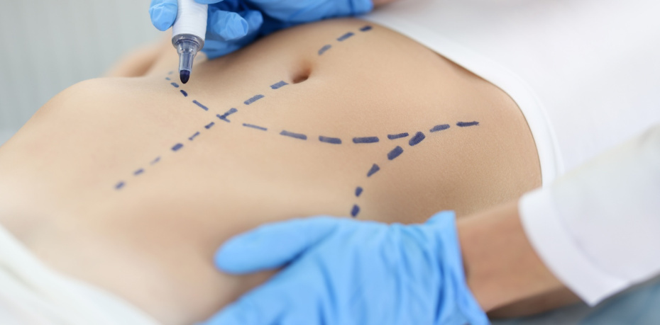    Shutterstock/FOTODOM