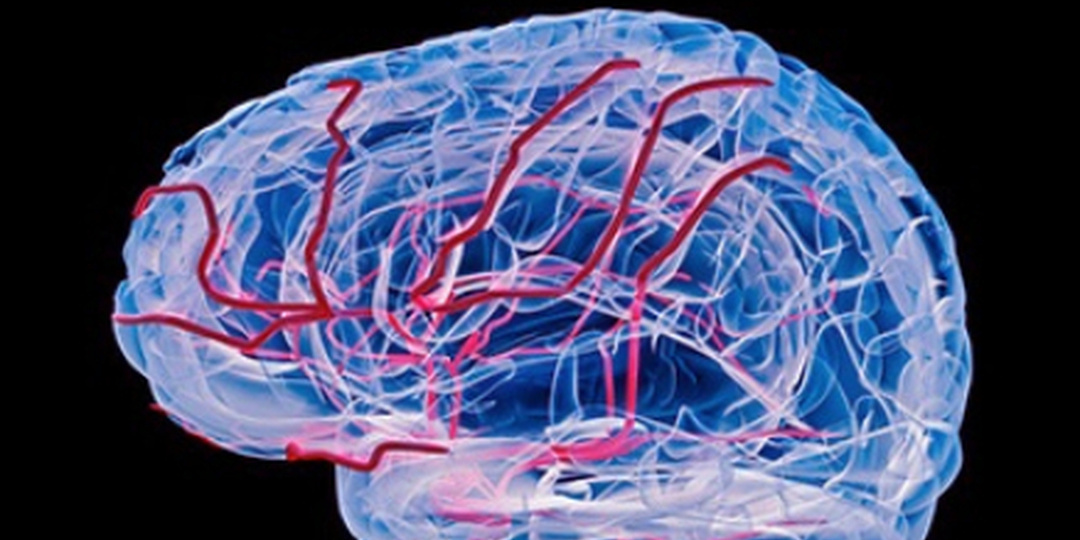 Мозговое кровообращение. Как сохранить и улучшить?