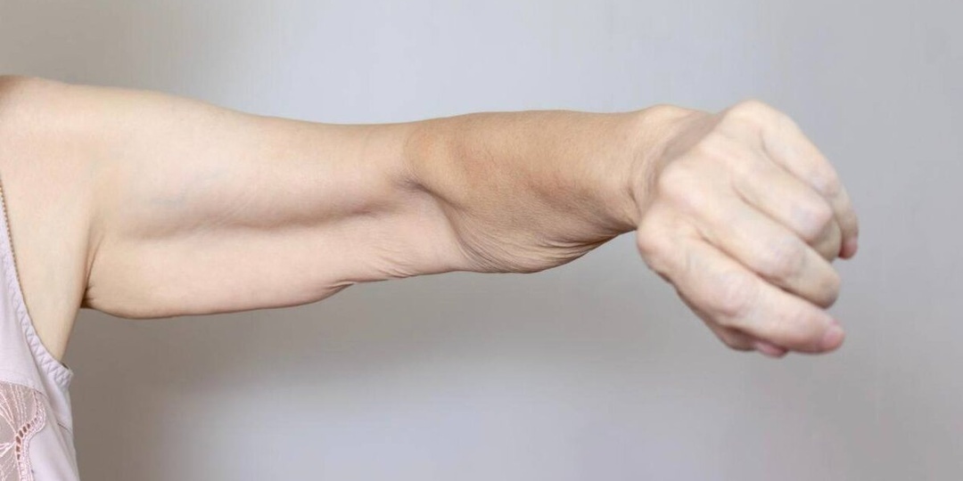 Саркопения: как избавиться раз и навсегда?